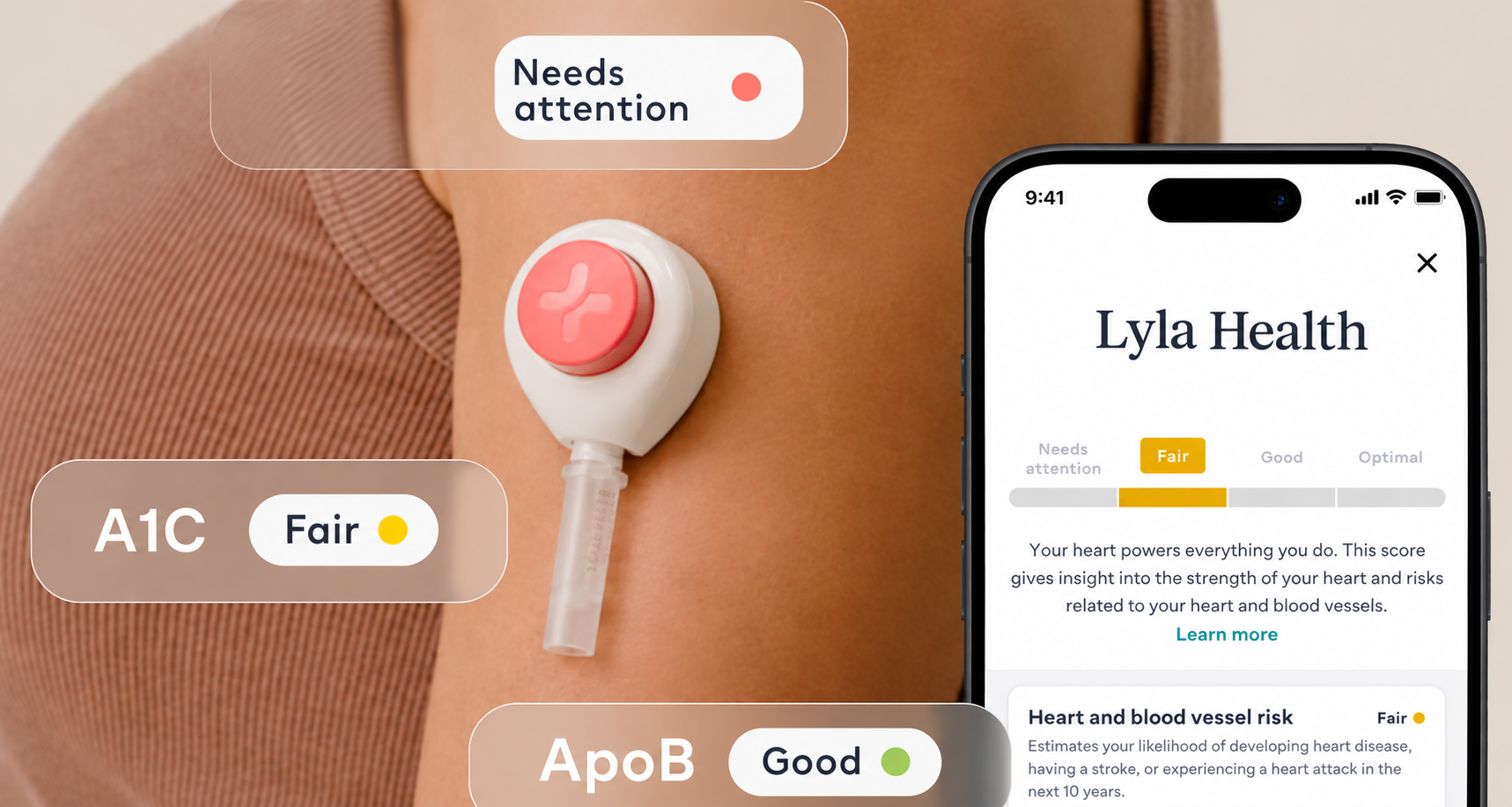 A glucose sensor on an arm beside a phone showing A1C and ApoB lab results in the Lyla Health app
